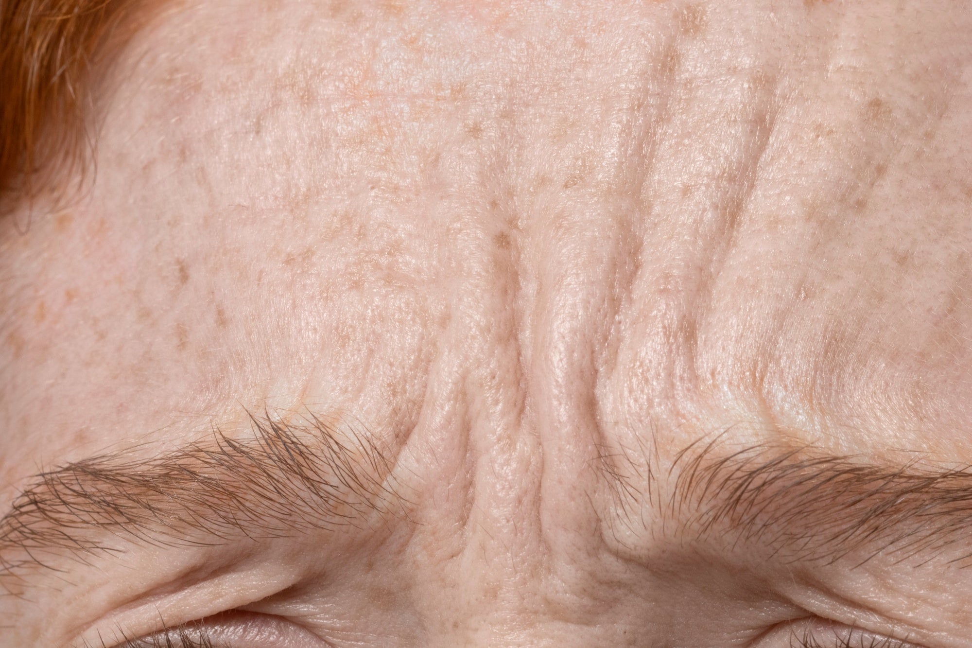 Peau premiers signes de l'âge ridules déshydratation fatigue ternissement